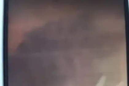 Kano Suspends Three Doctors Who Forgot Scissors in Patients Stomach